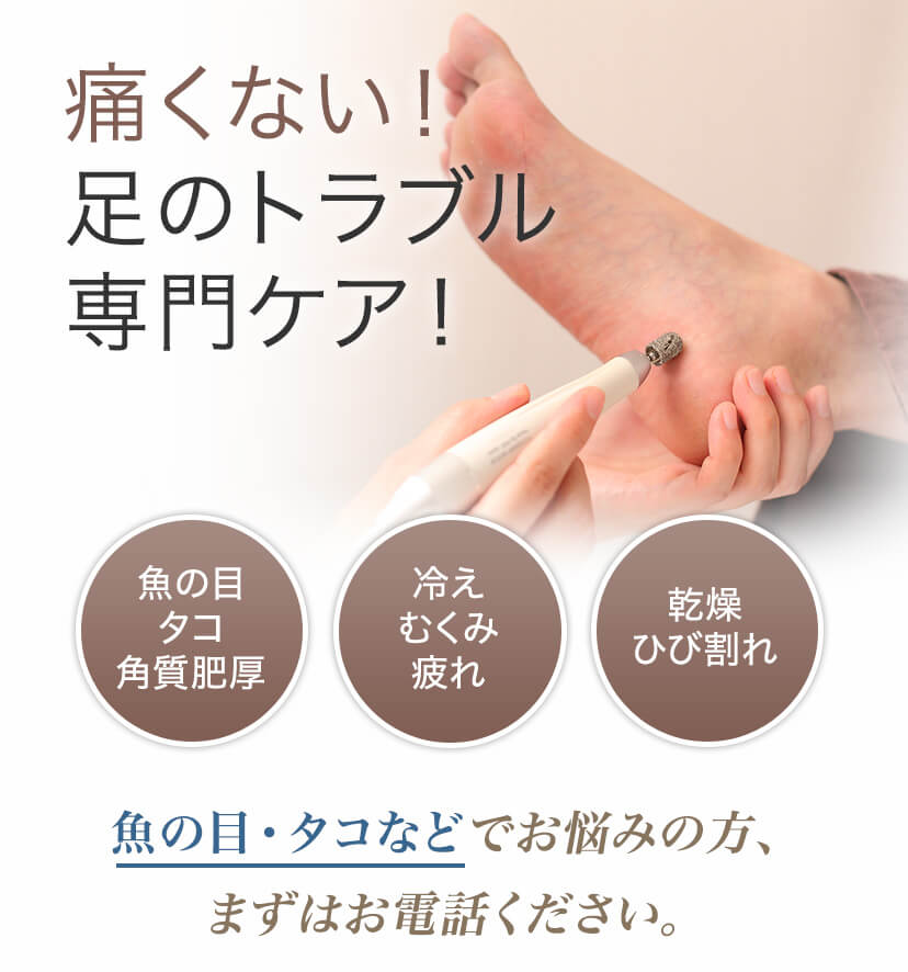 痛くない!足のトラブル専門ケア!魚の目・タコなどでお悩めの方、まずはお電話ください。