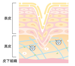 ケイ素が不足し肌がたるむ図