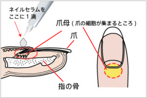 foriステムネイルセラムの塗り方