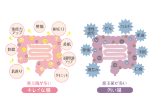 キレイな腸と汚い腸